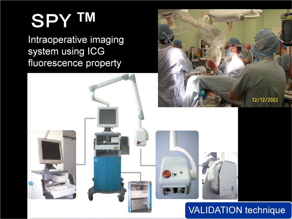 SPY is the graft validation modality to visualize the bypassed graft intra-operatively.