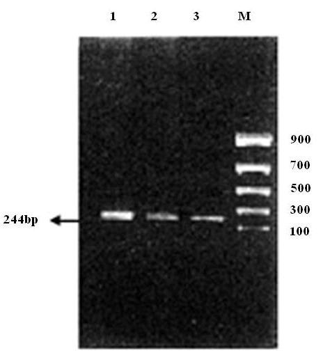 Figure 1 1 2 3 M Corresponding target band (244 base pairs) by nested polymerase chain reaction amplification.