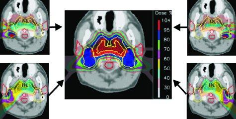 Clinical dosimetry in radiotherapy is well known matter but high conformal radiotherapy