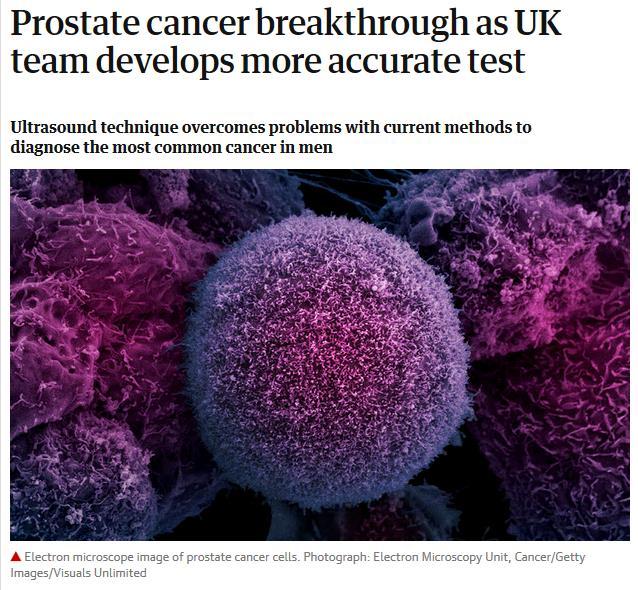 Not just liquid biopsy The Observer, 22 Apr 2018 A team of researchers at Dundee University have developed a new method offering