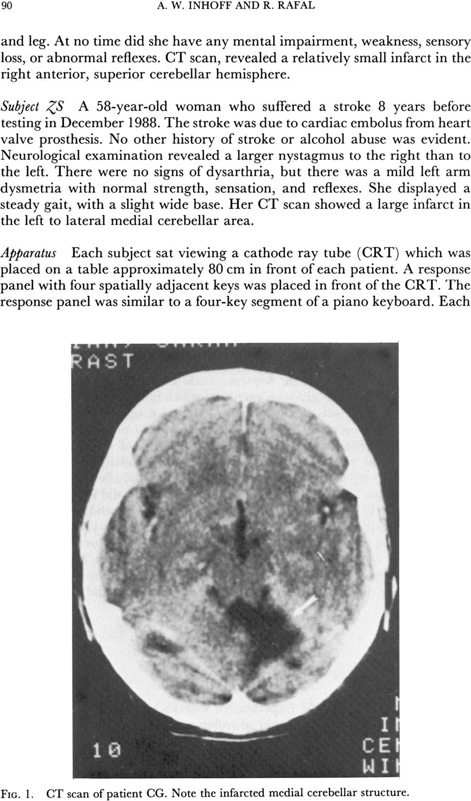 90 A. W. INHOFF AND R. RAFAL and leg. At no time did she have any mental impairment, weakness, sensory loss, or abnormal reflexes.