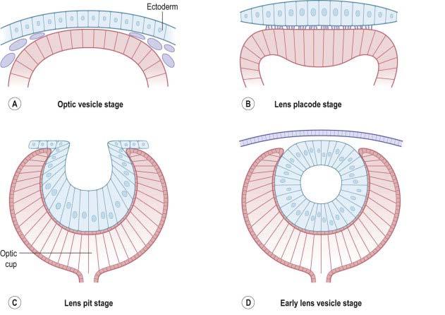 Sidebar Lenticular Embryology