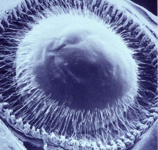 Lens Histology capsule surrounds entire lens basement membrane secreted by lens