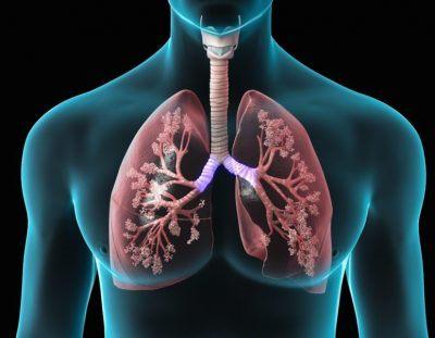 Respiratory Disease Dr Amal Damrah