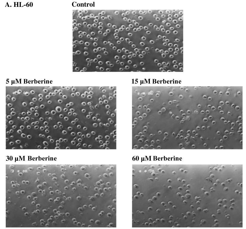 Figure 1. Morphological changes of HL-60 and WEHI-3 cells in response to berberine. HL-60 (panel A) and WEHI-3 (panel B) cells were treated with various concentrations of berberine for 24 h.