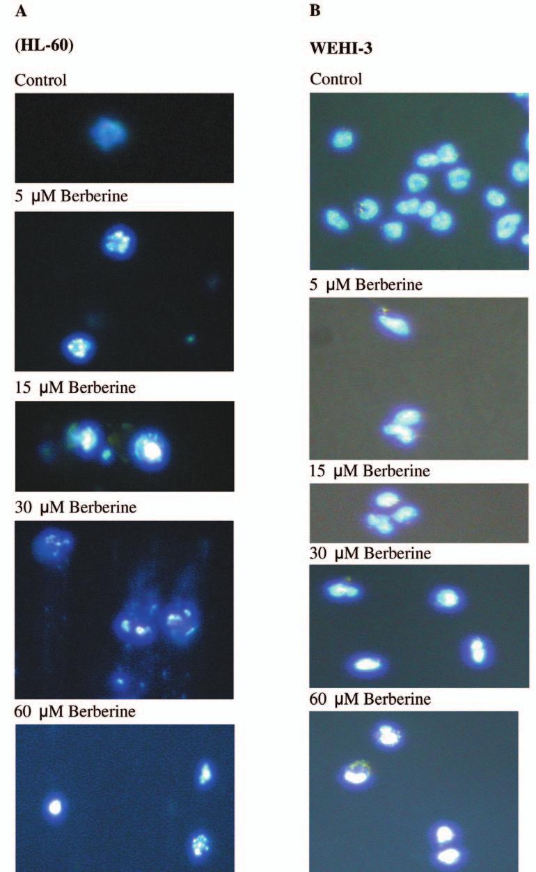 Lin et al: Berberine-induced Apoptosis of HL-60 and WEHI-3 Cells Figure 4. Berberine-induced apoptosis in HL-60 and WEHI-3 cells as examined by DAPI staining.
