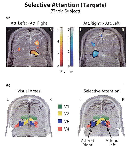 Effects of attention on early visual cortex!