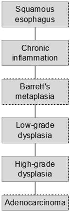 Evolution of Barrett s esophagus Injury Acid & bile reflux nitrous oxide Genetics Gender, race,?