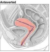 Orientation of the uterus The adult uterus is usually: Anteverted: tipped anterosuperiorly relative to the axis