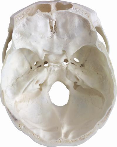 of the skull Art No / S L011 The maxilla