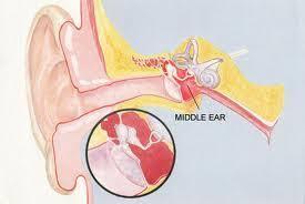 Other potential causes wax in the external ear
