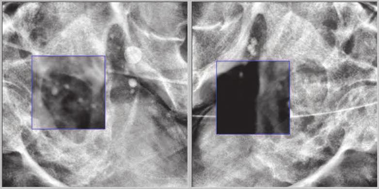 Superior figure shows the snapshot of 2D oblique X-ray images.