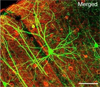Neuron Mesh Each neuron has many connections to other neurons Up to 10 15 neuronal connections in human brain 10 % for