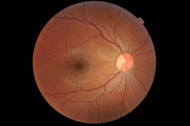 Circulation Inner 2/3 of retina are supplied by Retinal Artery Tight junctions form blood