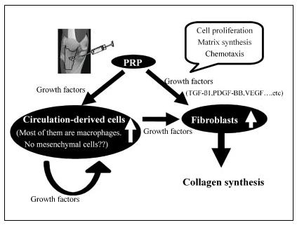 tenocytes and tenoblasts (figure 7) to accelerate the collagen synthesis and the tendon repair.
