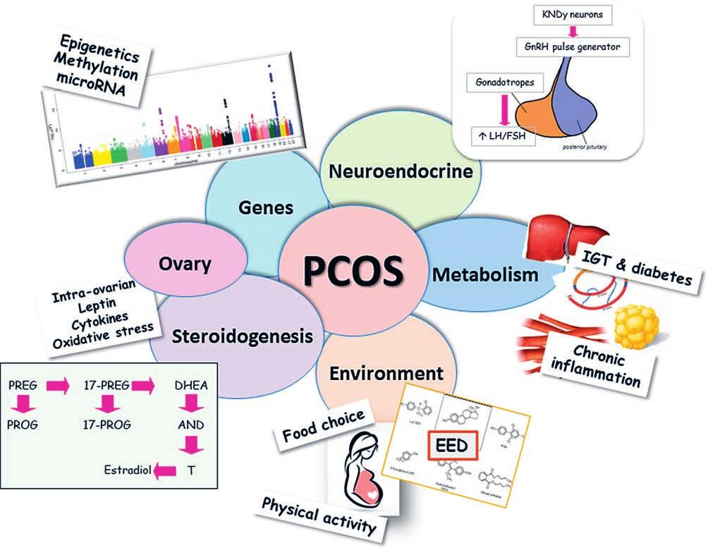 POLYCYSTIC OVARY SYNDROME PATHOPHYSIOLOGY Ibanez L, Oberfield SE, Witchel S, Auchus RJ, Chang RJ, Codener E, Dabadghao P, Darendeliler F, Elbarbary NS, Gambineri A, Garcia Rudaz C, Hoeger KM,
