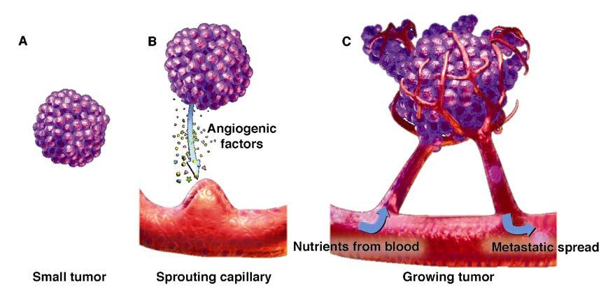 Tumor Angiogenesis and Neovasculature A, Tumors less than 1 mm 3 receive oxygen and nutrients by diffusion from host vasculature. B, Larger tumors require new vessel network.