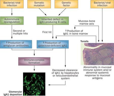 Proposed pathways involved in the mesangial deposition of IgA1 in IgA nephropathy a multihit