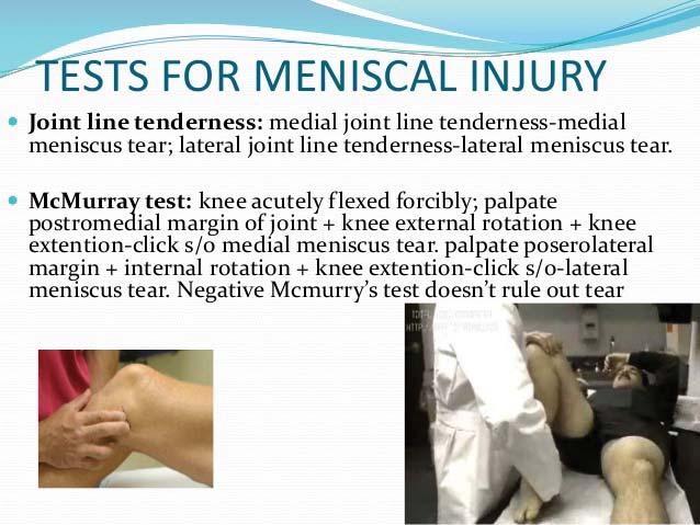 Tests For Meniscal Injury