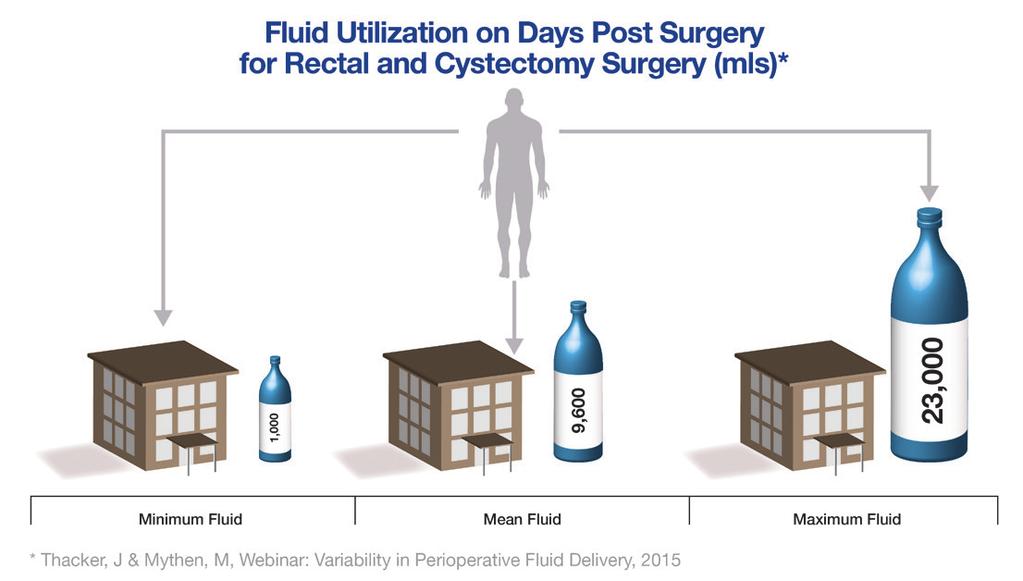 Key finding 3 There is wide variation in fluid practice between institutions OVER TWENTYFOLD variation exists in the median amount of perioperative fluid given to patients undergoing colonic surgery