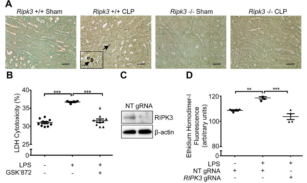 Supplemental Figure 3. Sepsis induces limited RIPK3-dependent cell death.