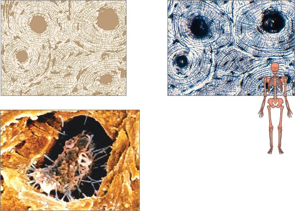 Connective Tissue Types Bone (Osseous Tissue) Solid matrix Supports Protects Forms blood cells Attachment for muscles Skeleton Osteocytes in lacunae Osteon Lamella Central