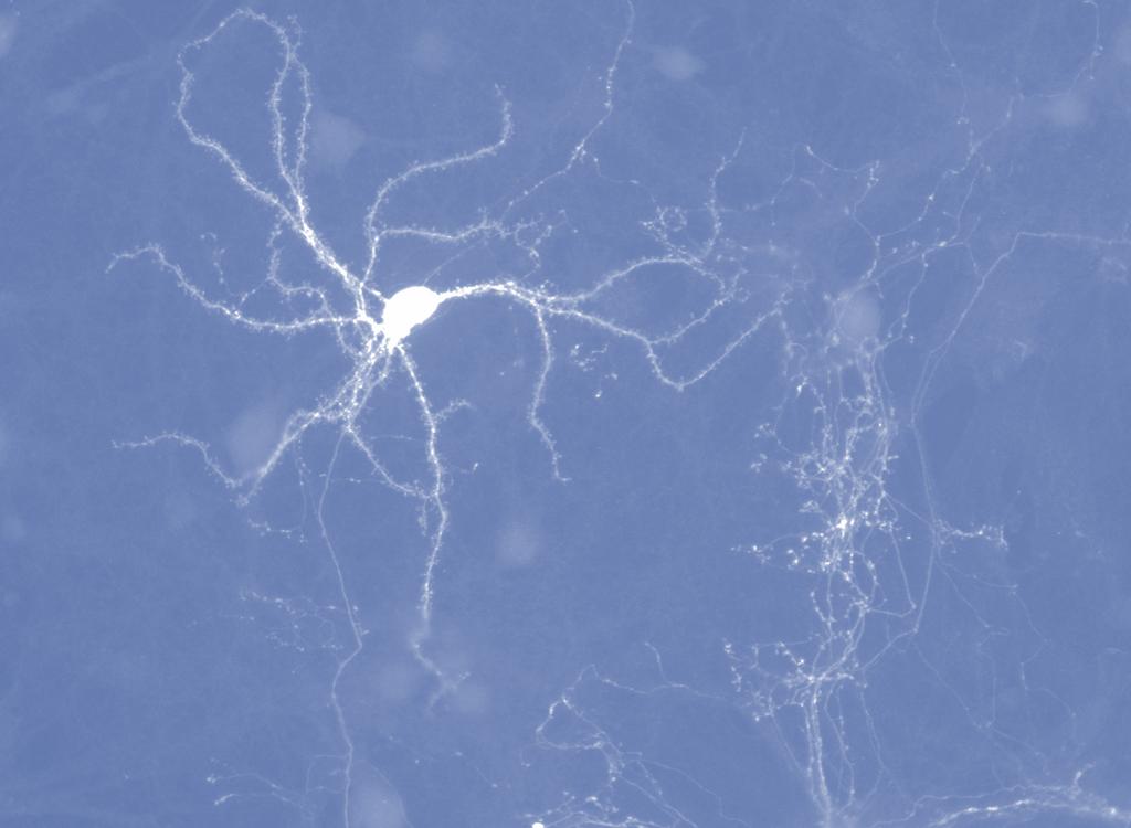 Developmental regulation of Medium Spiny Neuron