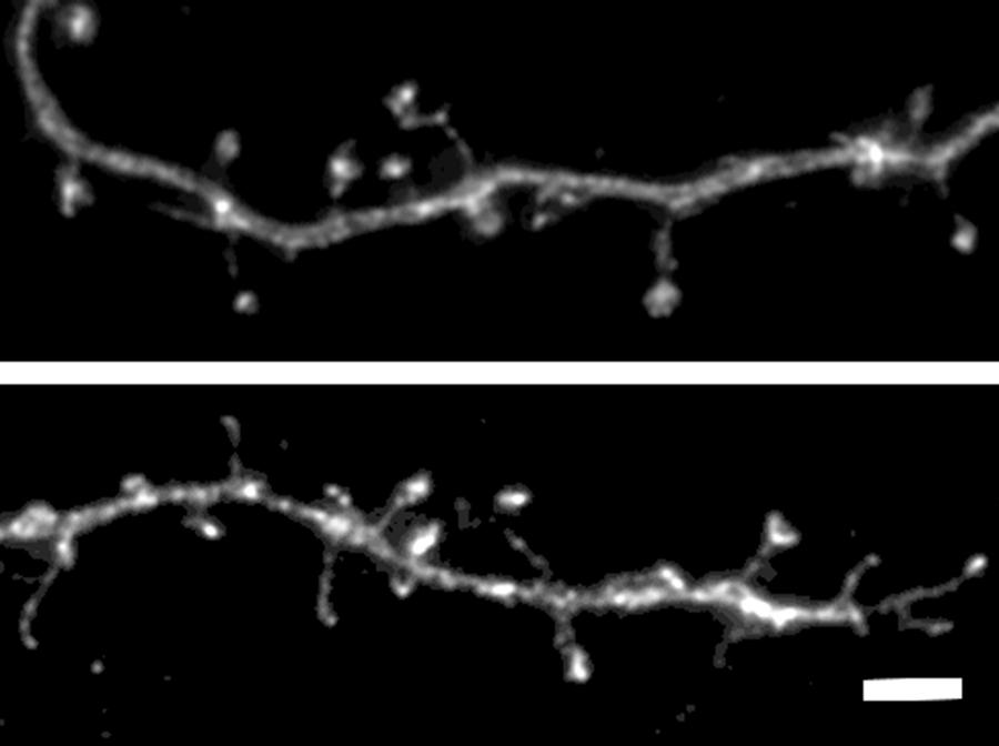 Effect of dopamine on development of dendritic spines - DA +DA