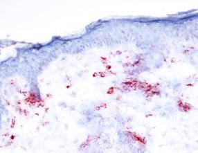 Representative immunohistochemical staining of human skin for the pdc-specific marker