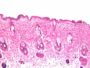 Sterile epidermal injury prompts a rapid and transient leukocyte infiltrate in the