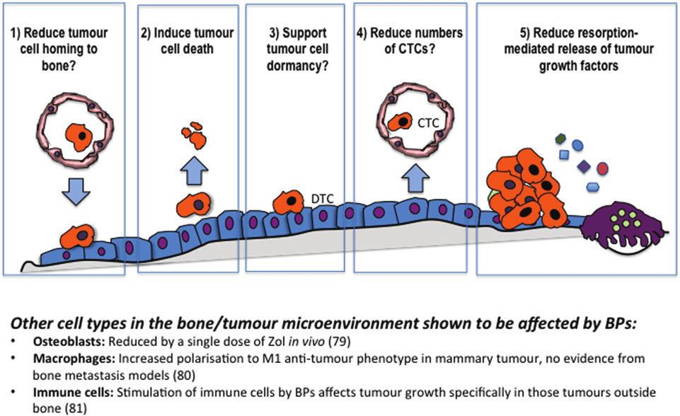 Annals of Oncology Figure 3. Potential effects of BPs in bone metastases. metastases are formed [56 59], if used on a repeated schedule and especially in combination with chemotherapy [60].