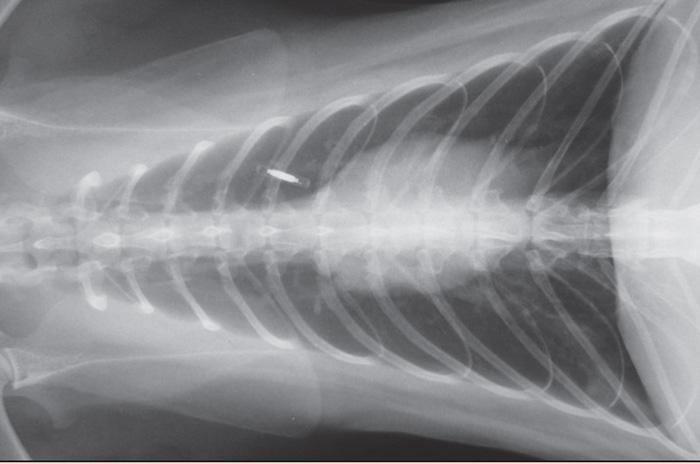 Middle: a radiograph demonstrating localised pneumonia in the