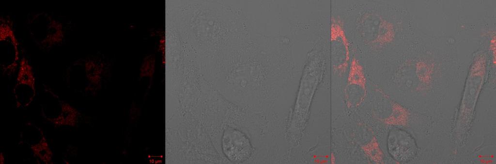 Confocal microscope images to show the targeting capability analysis of HA-Ir-Pyr in CD-44
