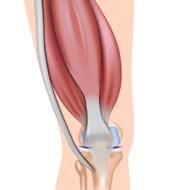 contracture Painful heel syndrome (Achilles tendinitis) Collagen Production Proper alignment