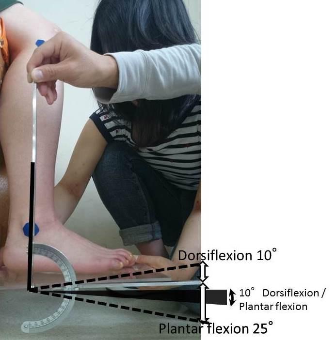 Primary Criterion #5 10 ankle dorsi / plantar flexion available in the range between 10 dorsiflexion and 25 plantar flexion. The test is conducted with the knee in 90.