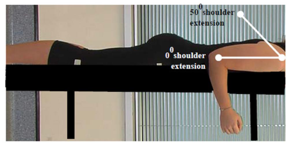 Criterion #2 Shoulder extension loss of 3 muscle grade points (muscle grade of two). The figure shows the athlete lying prone, shoulder in 0 extension and a line representing 50 extension.