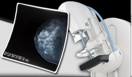 Should I Continue Getting Mammograms? -For Women Age 85 or older- This is a tool to help you make this decision.