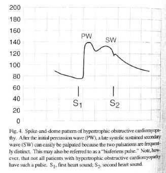 Bisferians pulse Hypertrophic