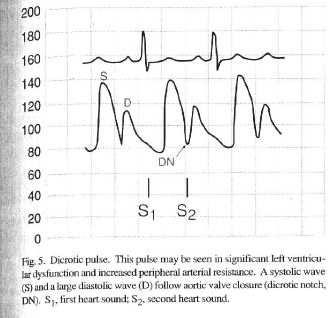 Dicrotic pulse LV