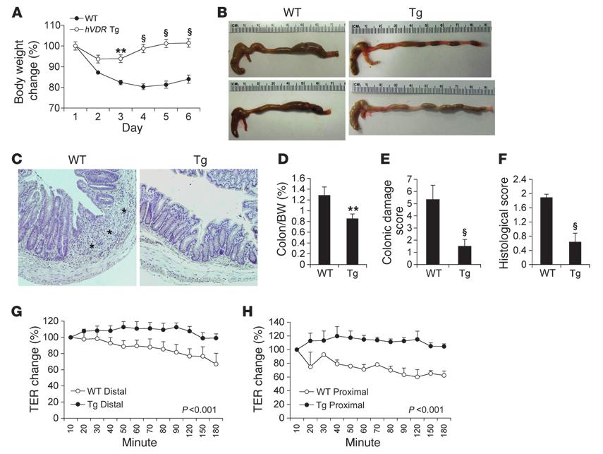 Figure 3 Epithelial hvdr expression protects against TNBS-induced colitis. (A) Changes in body weight (percentage of original body weight) over time (days) in WT and Tg mice following TNBS treatment.