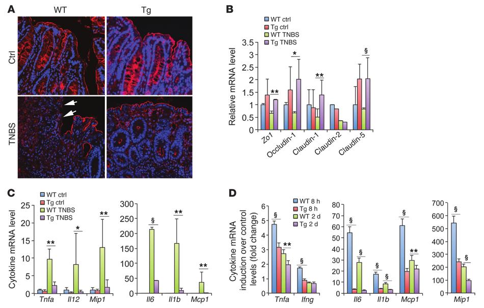 Figure 4 Epithelial hvdr preserves epithelial tight junctions and suppresses colonic inflammation in a TNBS-induced colitis model.