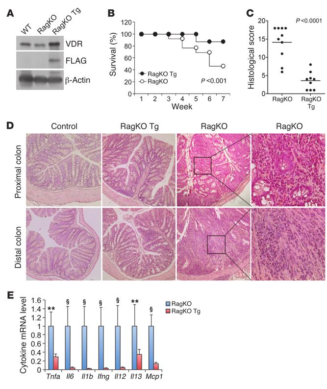 Figure 6 Epithelial hvdr inhibits colitis in a T cell transfer model of chronic colitis.
