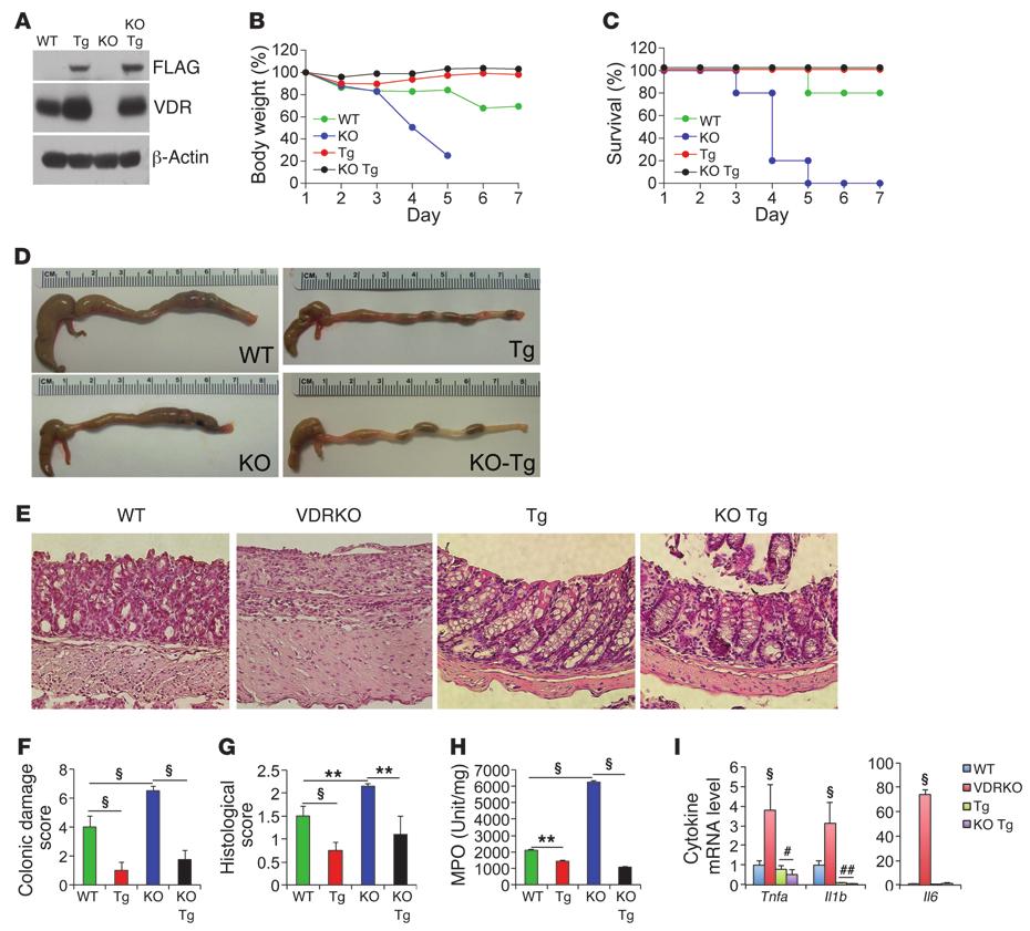 Figure 7 Reconstitution of VDR-null intestinal epithelial cells with the hvdr transgene rescues Vdr-null mice from colitis and death.