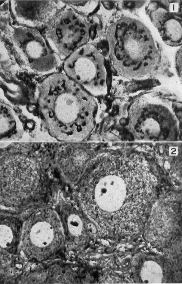 W. C. MA AND CHIEN-LIANG ~ ~ i j Fms. 1 AND 2. NORMAL SPINAL GANGLION CELL OF RAT Fig. 1 shows Golpi apparatus; Fig. 2 mitochondria. X 1000.
