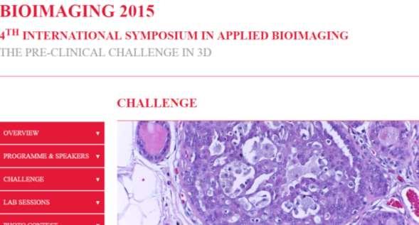 After implementation- new tools Automatic classification of tumor malignancy on breast histological pictures of hematoxylin & eosin stained slides Aim: CAD in breast specimens