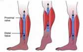 Venous Stasis: Insufficient Calf Muscle Pump Chain of pumps from foot to upper thigh; synchronize during walking 1. Dorsiflexion empties the distal calf pump 2. Weight bearing empties the foot pump 3.