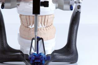 DFP the precision chain in dental technology DFP (Digital Functional Prosthetics) is an optimised working process