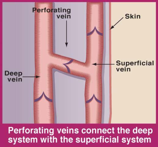 of superficial veins.