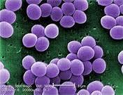 What is MRSA? Staphylococcus Aureus (S.