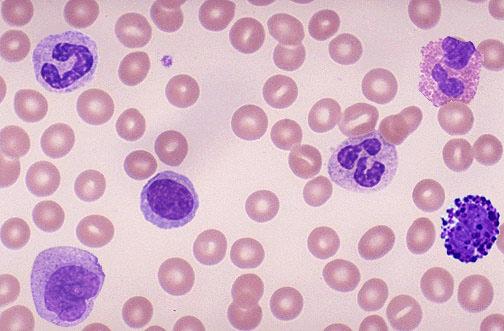html Polymorphonuclear leukocytes are also called Granulocytes They are characterized by having a multilobed nucleus and